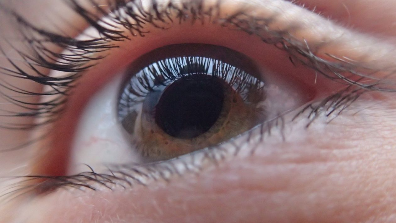 Ukázka fotky oka pro irisdiagnostiku